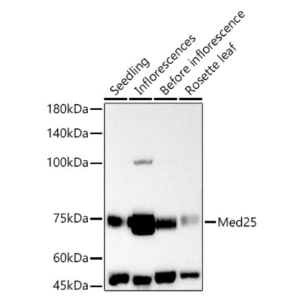 Western Blot - Anti-MED25 Antibody (A305325) - Antibodies.com