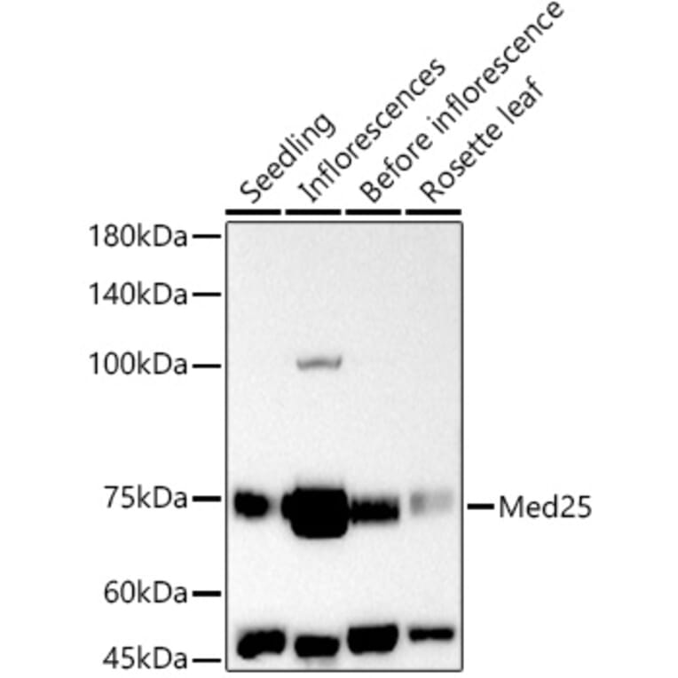 Western Blot - Anti-MED25 Antibody (A305325) - Antibodies.com