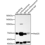 Western Blot - Anti-MED25 Antibody (A305325) - Antibodies.com