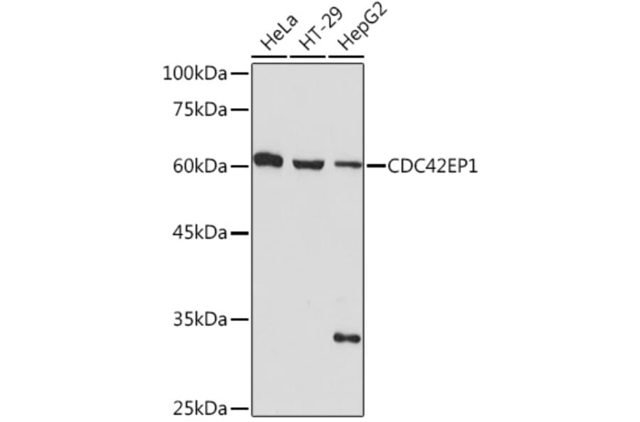 Western Blot - Anti-CDC42EP1 Antibody [ARC2298] (A305327) - Antibodies.com