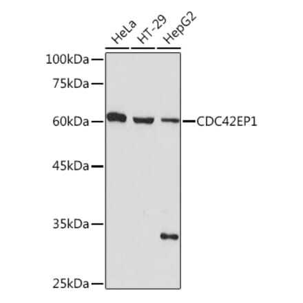 Western Blot - Anti-CDC42EP1 Antibody [ARC2298] (A305327) - Antibodies.com
