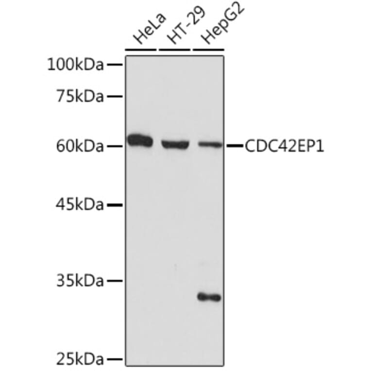 Western Blot - Anti-CDC42EP1 Antibody [ARC2298] (A305327) - Antibodies.com