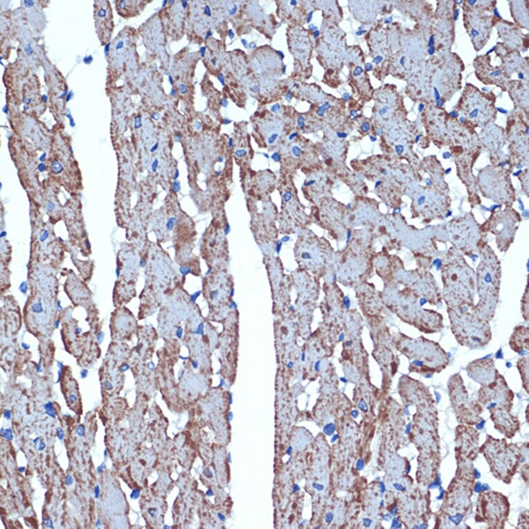 Immunohistochemistry - Anti-CDC42EP1 Antibody [ARC2298] (A305327) - Antibodies.com