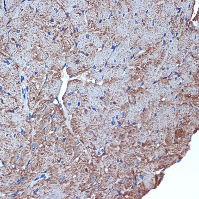 Immunohistochemistry - Anti-CDC42EP1 Antibody [ARC2298] (A305327) - Antibodies.com