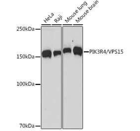 Western Blot - Anti-VPS15 Antibody [ARC2090] (A305330) - Antibodies.com