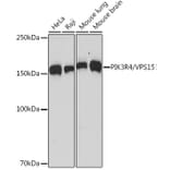 Western Blot - Anti-VPS15 Antibody [ARC2090] (A305330) - Antibodies.com