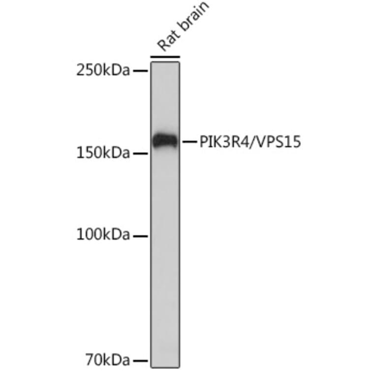 Western Blot - Anti-VPS15 Antibody [ARC2090] (A305330) - Antibodies.com