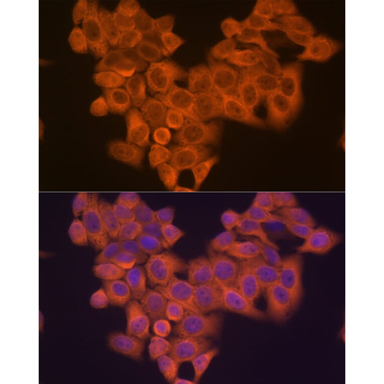 Immunofluorescence - Anti-VPS15 Antibody [ARC2090] (A305330) - Antibodies.com