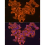 Immunofluorescence - Anti-VPS15 Antibody [ARC2090] (A305330) - Antibodies.com