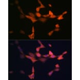Immunofluorescence - Anti-VPS15 Antibody [ARC2090] (A305330) - Antibodies.com