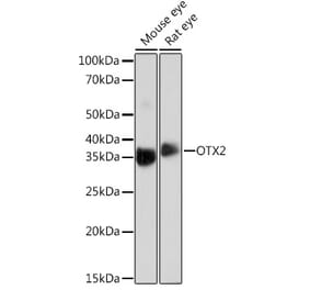 Western Blot - Anti-Otx2 Antibody [ARC0973] (A305331) - Antibodies.com