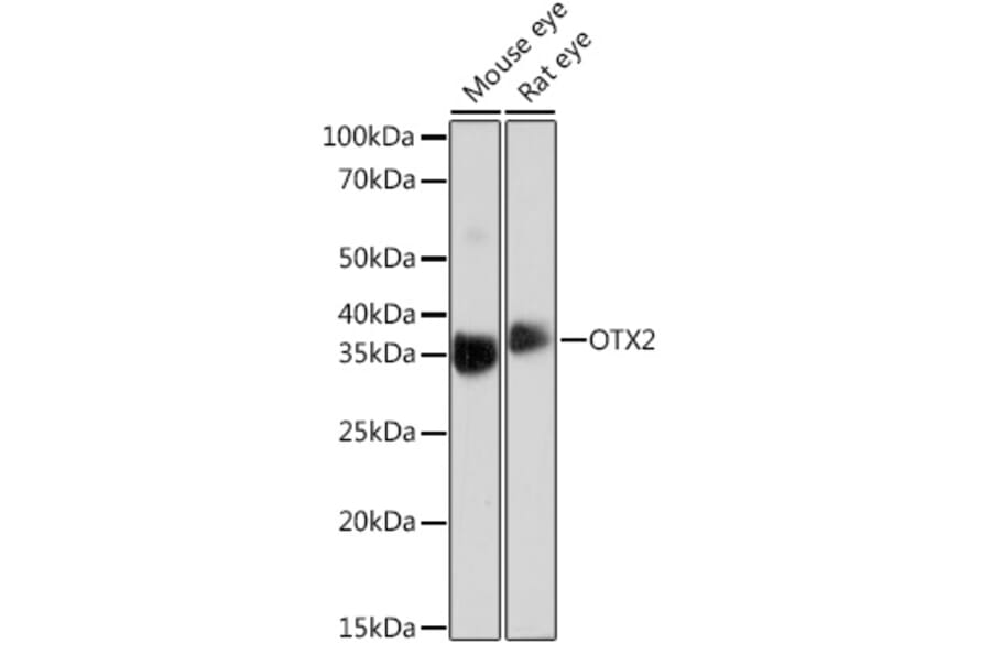 Western Blot - Anti-Otx2 Antibody [ARC0973] (A305331) - Antibodies.com