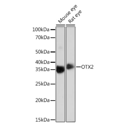 Western Blot - Anti-Otx2 Antibody [ARC0973] (A305331) - Antibodies.com