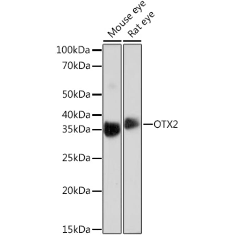 Western Blot - Anti-Otx2 Antibody [ARC0973] (A305331) - Antibodies.com