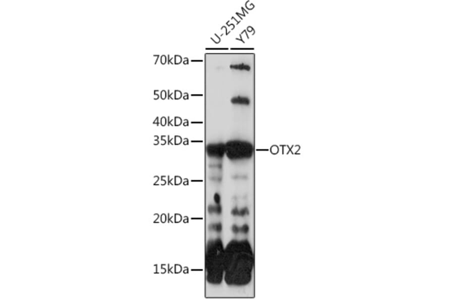 Western Blot - Anti-Otx2 Antibody [ARC0973] (A305331) - Antibodies.com