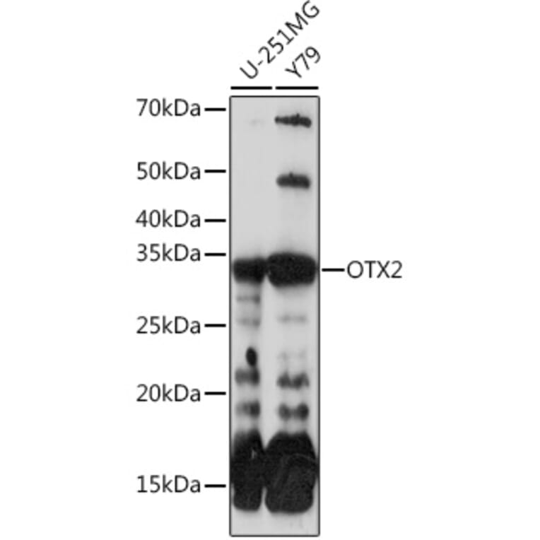 Western Blot - Anti-Otx2 Antibody [ARC0973] (A305331) - Antibodies.com