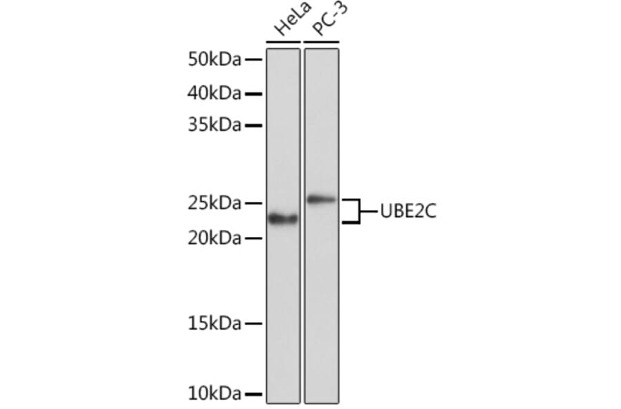 Western Blot - Anti-UBE2C Antibody [ARC1166] (A305332) - Antibodies.com