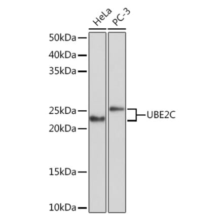 Western Blot - Anti-UBE2C Antibody [ARC1166] (A305332) - Antibodies.com