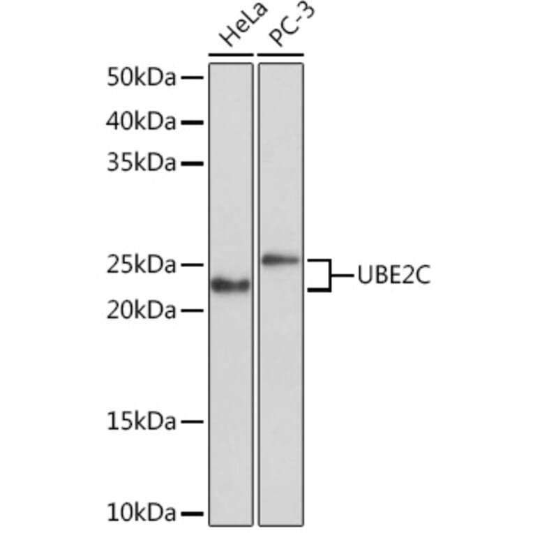 Western Blot - Anti-UBE2C Antibody [ARC1166] (A305332) - Antibodies.com