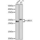 Western Blot - Anti-UBE2C Antibody [ARC1166] (A305332) - Antibodies.com