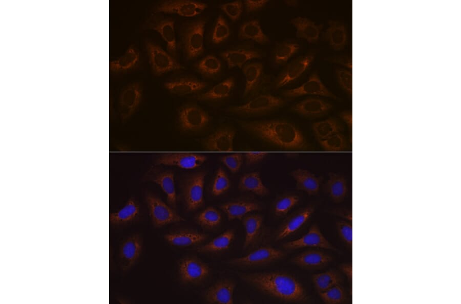 Immunofluorescence - Anti-UBE2C Antibody [ARC1166] (A305332) - Antibodies.com