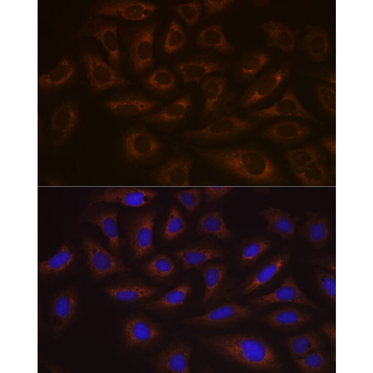Immunofluorescence - Anti-UBE2C Antibody [ARC1166] (A305332) - Antibodies.com