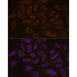 Immunofluorescence - Anti-UBE2C Antibody [ARC1166] (A305332) - Antibodies.com