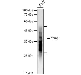 Western Blot - Anti-CD63 Antibody [ARC51703] (A305333) - Antibodies.com