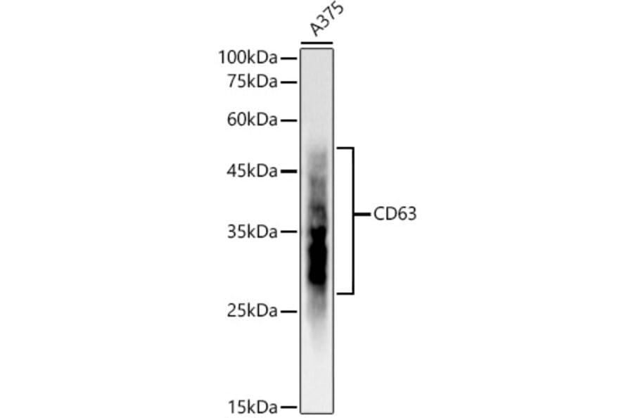 Western Blot - Anti-CD63 Antibody [ARC51703] (A305333) - Antibodies.com