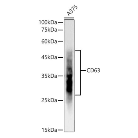 Western Blot - Anti-CD63 Antibody [ARC51703] (A305333) - Antibodies.com