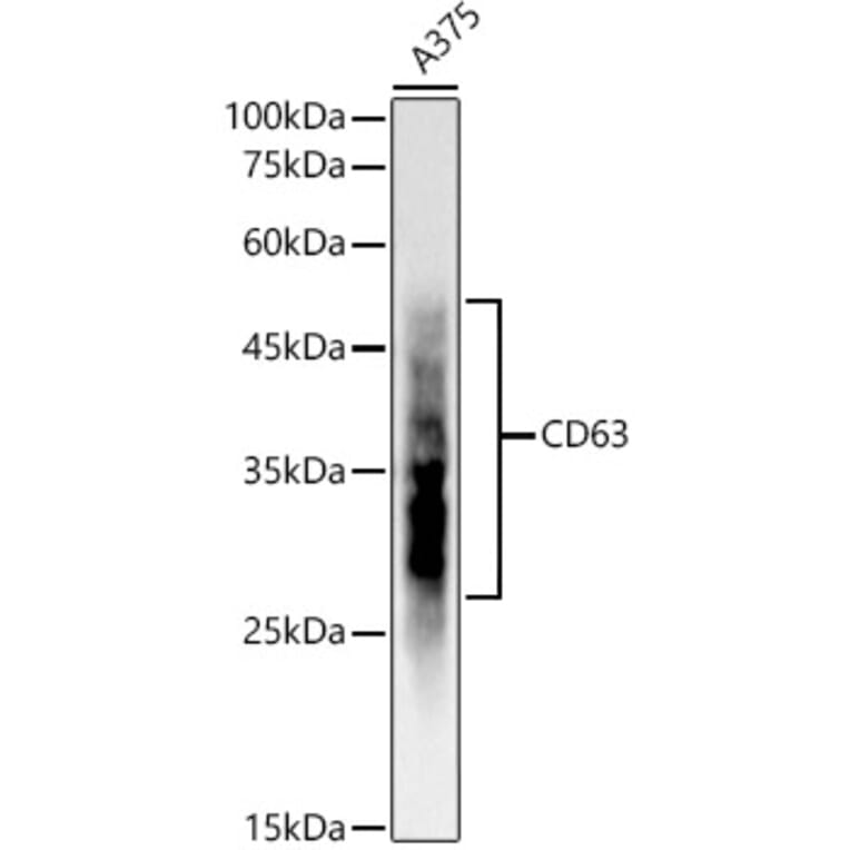 Western Blot - Anti-CD63 Antibody [ARC51703] (A305333) - Antibodies.com