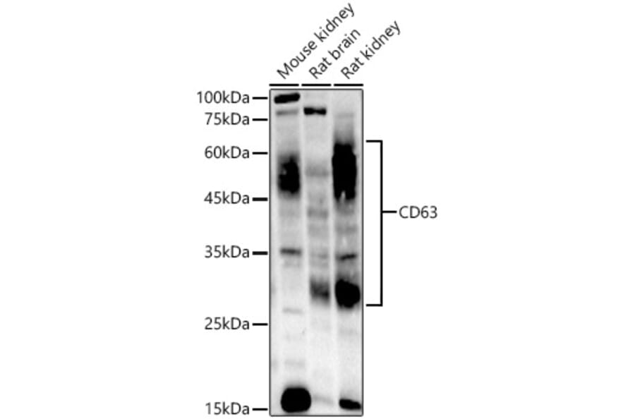 Western Blot - Anti-CD63 Antibody [ARC51703] (A305333) - Antibodies.com