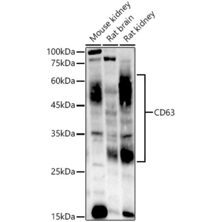 Western Blot - Anti-CD63 Antibody [ARC51703] (A305333) - Antibodies.com