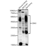 Western Blot - Anti-CD63 Antibody [ARC51703] (A305333) - Antibodies.com