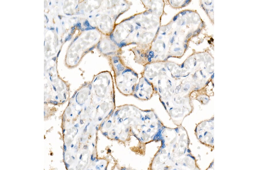Western Blot - Anti-CD63 Antibody [ARC51703] (A305333) - Antibodies.com