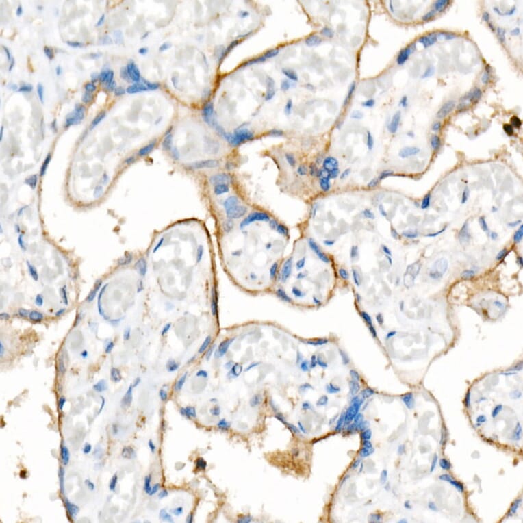 Western Blot - Anti-CD63 Antibody [ARC51703] (A305333) - Antibodies.com