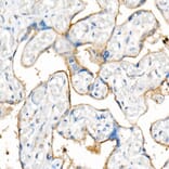 Western Blot - Anti-CD63 Antibody [ARC51703] (A305333) - Antibodies.com
