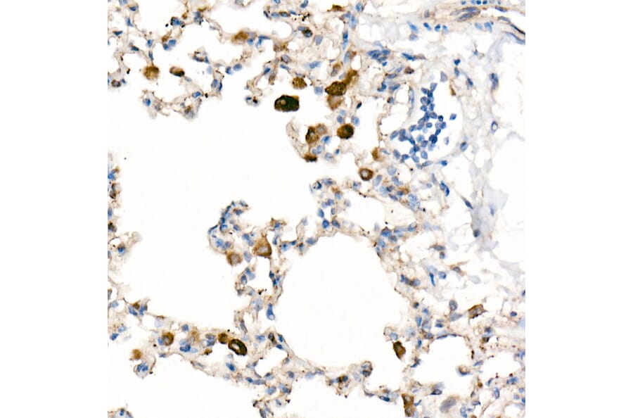 Immunohistochemistry - Anti-CD63 Antibody [ARC51703] (A305333) - Antibodies.com
