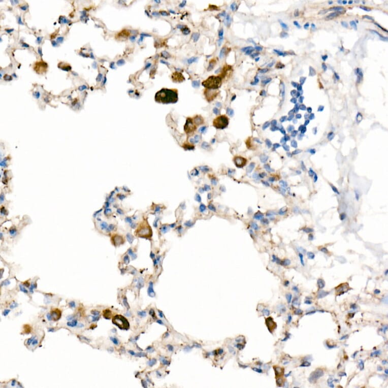 Immunohistochemistry - Anti-CD63 Antibody [ARC51703] (A305333) - Antibodies.com