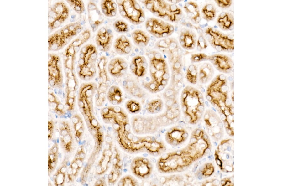 Immunohistochemistry - Anti-CD63 Antibody [ARC51703] (A305333) - Antibodies.com
