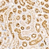 Immunohistochemistry - Anti-CD63 Antibody [ARC51703] (A305333) - Antibodies.com