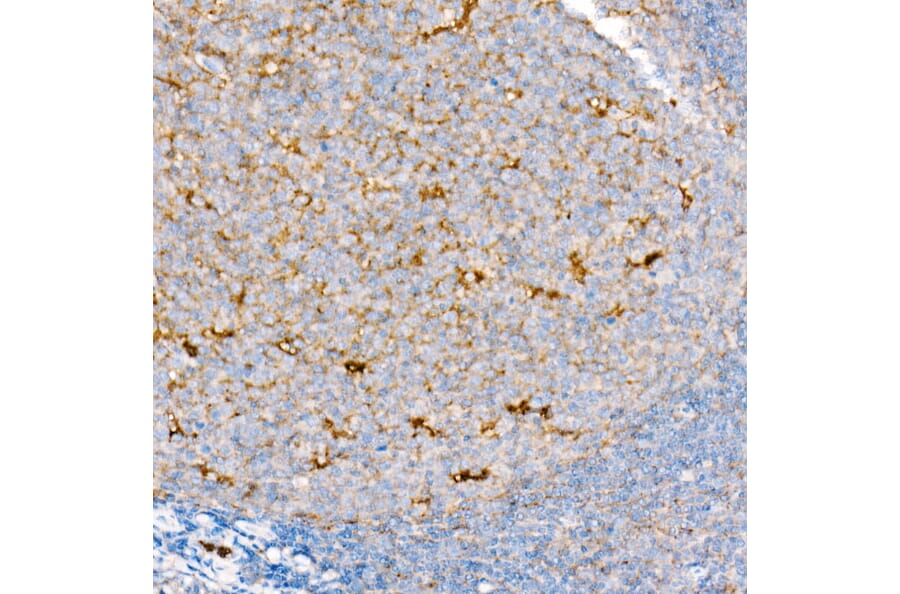 Immunohistochemistry - Anti-CD63 Antibody [ARC51703] (A305333) - Antibodies.com