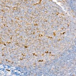 Immunohistochemistry - Anti-CD63 Antibody [ARC51703] (A305333) - Antibodies.com