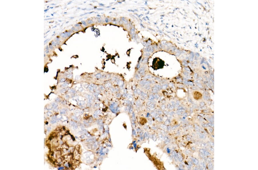 Immunohistochemistry - Anti-CD63 Antibody [ARC51703] (A305333) - Antibodies.com