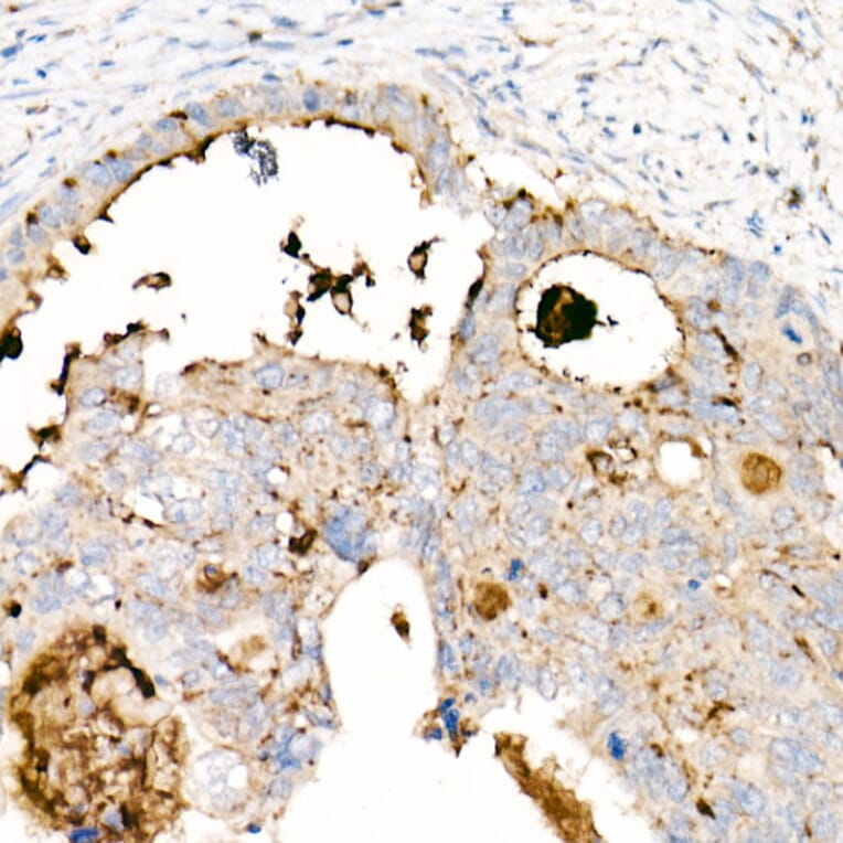 Immunohistochemistry - Anti-CD63 Antibody [ARC51703] (A305333) - Antibodies.com