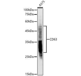 Western Blot - Anti-CD63 Antibody [ARC51690] (A305334) - Antibodies.com