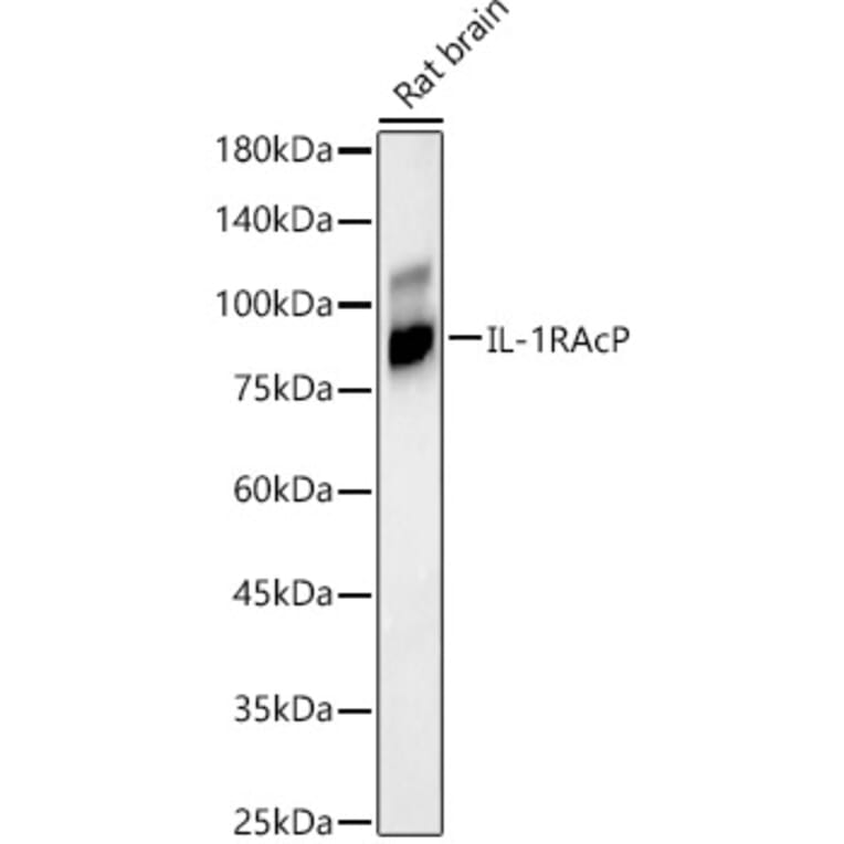 Western Blot - Anti-IL-1RAcP Antibody [ARC56983] (A305335) - Antibodies.com