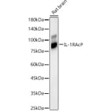 Western Blot - Anti-IL-1RAcP Antibody [ARC56983] (A305335) - Antibodies.com