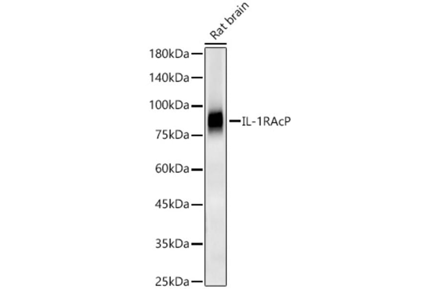 Western Blot - Anti-IL-1RAcP Antibody [ARC56983] (A305335) - Antibodies.com