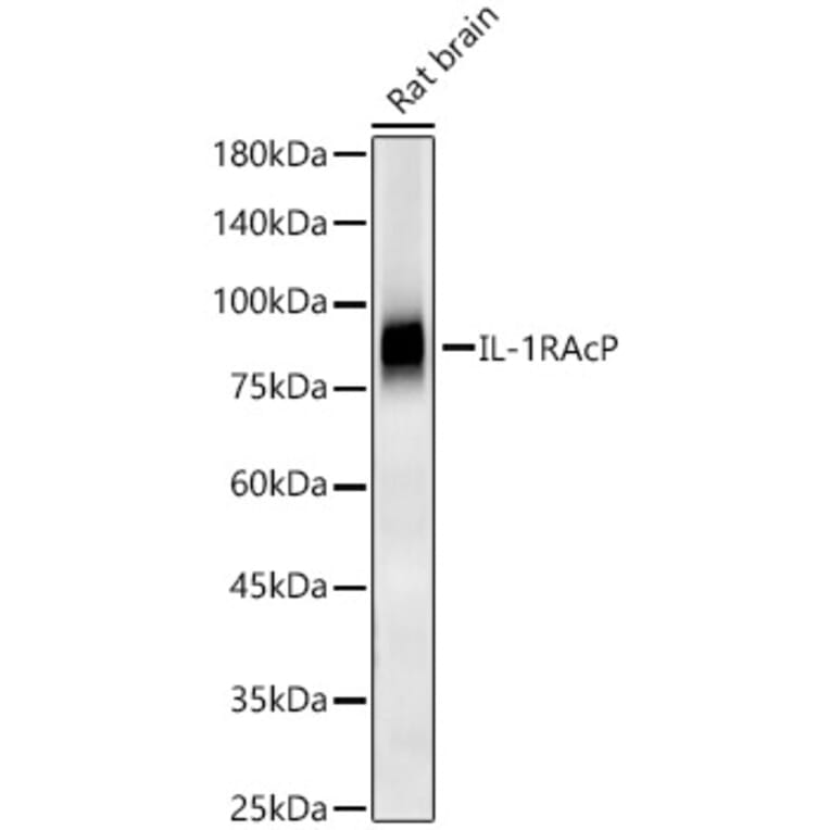 Western Blot - Anti-IL-1RAcP Antibody [ARC56983] (A305335) - Antibodies.com